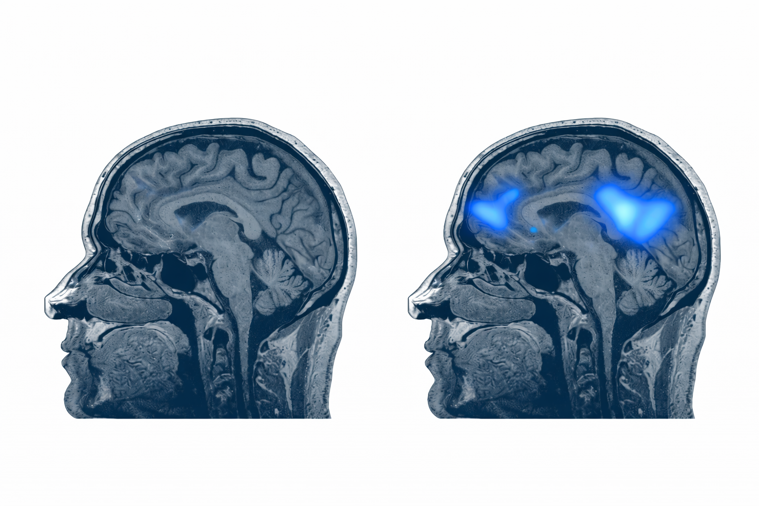 Visual comparison for: What even is hypnosis, really?